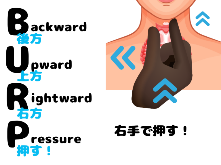 5分でわかる！【全身麻酔の基本⑦】経口挿管介助の方法と準備物品 | ナースジャーナル